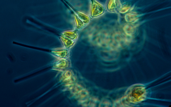 Uncoupling Autotrophy Heterotrophy