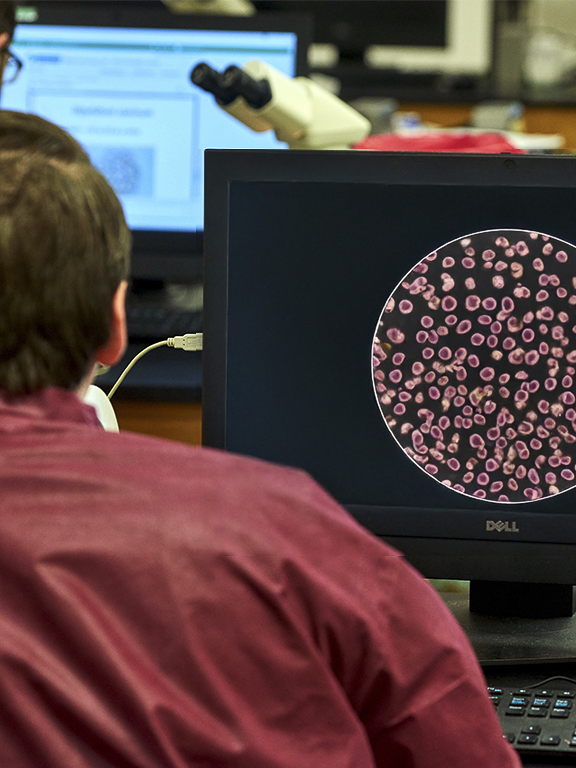 A student sitting in front of a computer with a microscopic view of red blood cells on the screen.